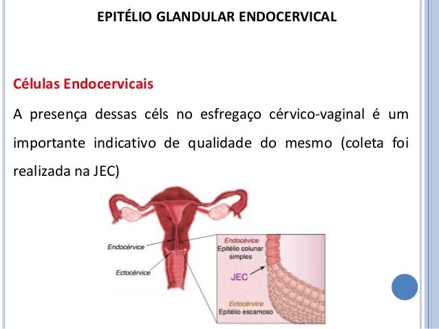 Presenza Della Componente Endocervicale Cosa Significa