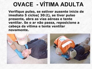 OVACE - VÍTIMA ADULTA
Verifique pulso, se estiver ausente inicie de
imediato 5 ciclos( 30:2), se tiver pulso
presente, abra as vias aéreas e tente
ventilar. Se o ar não passa, reposicione a
cabeça da vítima e tente ventilar
novamente.
 