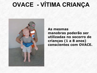 OVACE - VÍTIMA CRIANÇA
As mesmas
manobras poderão ser
utilizadas no socorro de
crianças (1 a 8 anos)
conscientes com OVACE.
 