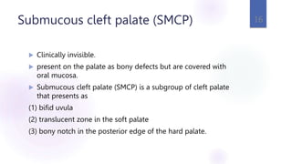 Submucous cleft palate (SMCP)
 Clinically invisible.
 present on the palate as bony defects but are covered with
oral mucosa.
 Submucous cleft palate (SMCP) is a subgroup of cleft palate
that presents as
(1) bifid uvula
(2) translucent zone in the soft palate
(3) bony notch in the posterior edge of the hard palate.
16
 