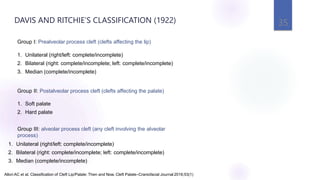 35
Allori AC et al. Classification of Cleft Lip/Palate: Then and Now. Cleft Palate–Craniofacial Journal 2016;53(1)
Group I: Prealveolar process cleft (clefts affecting the lip)
1. Unilateral (right/left: complete/incomplete)
2. Bilateral (right: complete/incomplete; left: complete/incomplete)
3. Median (complete/incomplete)
Group II: Postalveolar process cleft (clefts affecting the palate)
1. Soft palate
2. Hard palate
Group III: alveolar process cleft (any cleft involving the alveolar
process)
1. Unilateral (right/left: complete/incomplete)
2. Bilateral (right: complete/incomplete; left: complete/incomplete)
3. Median (complete/incomplete)
DAVIS AND RITCHIE’S CLASSIFICATION (1922)
 