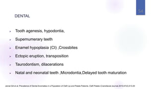 54
 Tooth agenesis, hypodontia,
 Supernumerary teeth
 Enamel hypoplasia (CI) ,Crossbites
 Ectopic eruption, transposition
 Taurodontism, dilacerations
 Natal and neonatal teeth ,Microdontia,Delayed tooth maturation
Jamal GA et al. Prevalence of Dental Anomalies in a Population of Cleft Lip and Palate Patients. Cleft Palate–Craniofacial Journal,2010;47(4):413-20
DENTAL
 