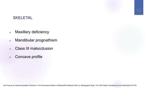  Maxillary deficiency
 Mandibular prognathism
 Class III malocclusion
 Concave profile
Ana Paula et al, Dental Anomalies of Number in The Permanent Dentition ofPatientsWith Bilateral Cleft Lip: Radiographic Study, The Cleft Palate-Craniofacial Journal.2008;45(5):473-476.
SKELETAL
55
 