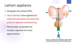 Latham appliance
 Georgiade and Latham(1976).
 A pin-retained, active appliance to
retract the premaxilla and expand the
posterior segments simultaneously.
 Mechanically manipulates the
maxillary segments into close
approximation.
71
 