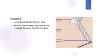 Components
(1) conventional acrylic intraoral plate
(2) dynamic nasal bumper attached to the
vestibular flange of the intraoral plate
89
 