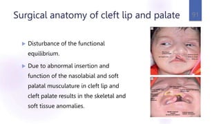 Surgical anatomy of cleft lip and palate
 Disturbance of the functional
equilibrium.
 Due to abnormal insertion and
function of the nasolabial and soft
palatal musculature in cleft lip and
cleft palate results in the skeletal and
soft tissue anomalies.
91
 