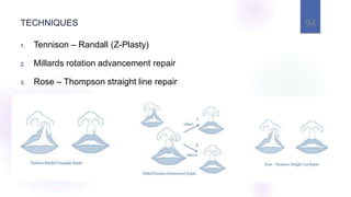 TECHNIQUES 94
1. Tennison – Randall (Z-Plasty)
2. Millards rotation advancement repair
3. Rose – Thompson straight line repair
 