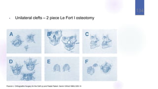 • Unilateral clefts – 2 piece Le Fort I osteotomy
Posnick J. Orthognathic Surgery for the Cleft Lip and Palate Patient. Semin Orthod1996;2:205-14
134
 