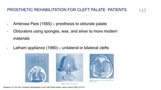 • Ambrose Pare (1565) – prosthesis to obturate palate
• Obturators using sponges, wax, and silver to more modern
materials
• Latham appliance (1980) – unilateral or bilateral clefts
PROSTHETIC REHABILITATION FOR CLEFT PALATE PATIENTS 137
Gardener LK, Parr GR. Prosthetic Rehabilitation of the Cleft Palate Patient. Semin Orthod1996;2:215-19
 