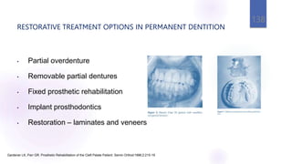 RESTORATIVE TREATMENT OPTIONS IN PERMANENT DENTITION
138
• Partial overdenture
• Removable partial dentures
• Fixed prosthetic rehabilitation
• Implant prosthodontics
• Restoration – laminates and veneers
Gardener LK, Parr GR. Prosthetic Rehabilitation of the Cleft Palate Patient. Semin Orthod1996;2:215-19
 