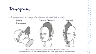 Tomogram
• A tomogram is an image of a plane or slice within the body.
 