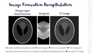 Image Formation Recapitulation
We take multiple projection at different angles ➔ form a sinogram ➔ the sinogram
can be reconstructed into an image using filtered backprojection ➔ we get CT image.
 