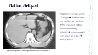Motion Artifact
• Patient moves when taking
CT image ➔ Shift between
one rotation and another
➔ the image will not be
reconstructed very
faithfully ➔ sometimes will
form line in CT image ➔
motion artifact.
 