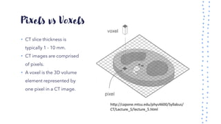 Pixels vs Voxels
• CT slice thickness is
typically 1 - 10 mm.
• CT images are comprised
of pixels.
• A voxel is the 3D volume
element represented by
one pixel in a CT image.
 