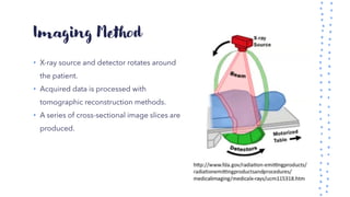 Imaging Method
• X-ray source and detector rotates around
the patient.
• Acquired data is processed with
tomographic reconstruction methods.
• A series of cross-sectional image slices are
produced.
 