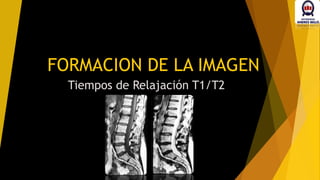 FORMACION DE LA IMAGEN
Tiempos de Relajación T1/T2
 
