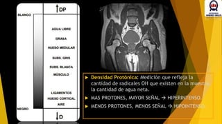  Densidad Protónica: Medición que refleja la
cantidad de radicales OH que existen en la muestra,
la cantidad de agua neta.
 MAS PROTONES, MAYOR SEÑAL  HIPERINTENSO.
 MENOS PROTONES, MENOS SEÑAL  HIPOINTENSO.
 
