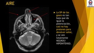 AIRE
 La DP de los
gases es tan
baja que da
igual la
potenciación,
casi no hay
protones para
devolver señal,
y se ven
totalmente
NEGROS/
HIPOINTENSO.
 