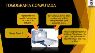 Uso de Rayos X.
Representa una
sección transversal
del cuerpo en
estudio.
Es “Computada” es decir
requiere una análisis
computacional para
procesar datos.
Imagen digital mediante
distintas “tonalidades de
gris” que representan
las diferencias entre los
tejidos.
TOMOGRAFÍA COMPUTADA
 