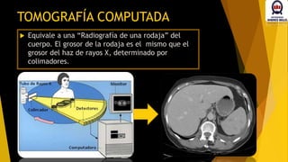 Equivale a una “Radiografía de una rodaja” del
cuerpo. El grosor de la rodaja es el mismo que el
grosor del haz de rayos X, determinado por
colimadores.
TOMOGRAFÍA COMPUTADA
 