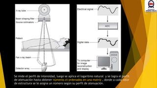 Se mide el perfil de intensidad, luego se aplica el logaritmo natural y se logra el perfil
de atenuación hasta obtener números ct ordenados en una matriz , donde a cada valor
de estructura se le asigna un número según su perfil de atenuación.
 