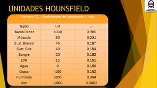 UNIDADES HOUNSFIELD
 