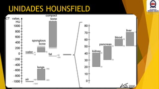 UNIDADES HOUNSFIELD
 