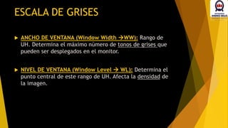 ESCALA DE GRISES
 ANCHO DE VENTANA (Window Width WW): Rango de
UH. Determina el máximo número de tonos de grises que
pueden ser desplegados en el monitor.
 NIVEL DE VENTANA (Window Level  WL): Determina el
punto central de este rango de UH. Afecta la densidad de
la imagen.
 