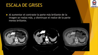  Al aumentar el contraste la parte más brillante de la
imagen se realza más, y disminuye el realce de la parte
menos brillante.
ESCALA DE GRISES
 