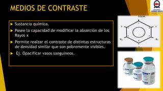  Sustancia química.
 Posee la capacidad de modificar la absorción de los
Rayos x
 Permite realzar el contraste de distintas estructuras
de densidad similar que son pobremente visibles.
 Ej. Opacificar vasos sanguíneos.
MEDIOS DE CONTRASTE
 