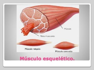 Músculo esquelético.
 