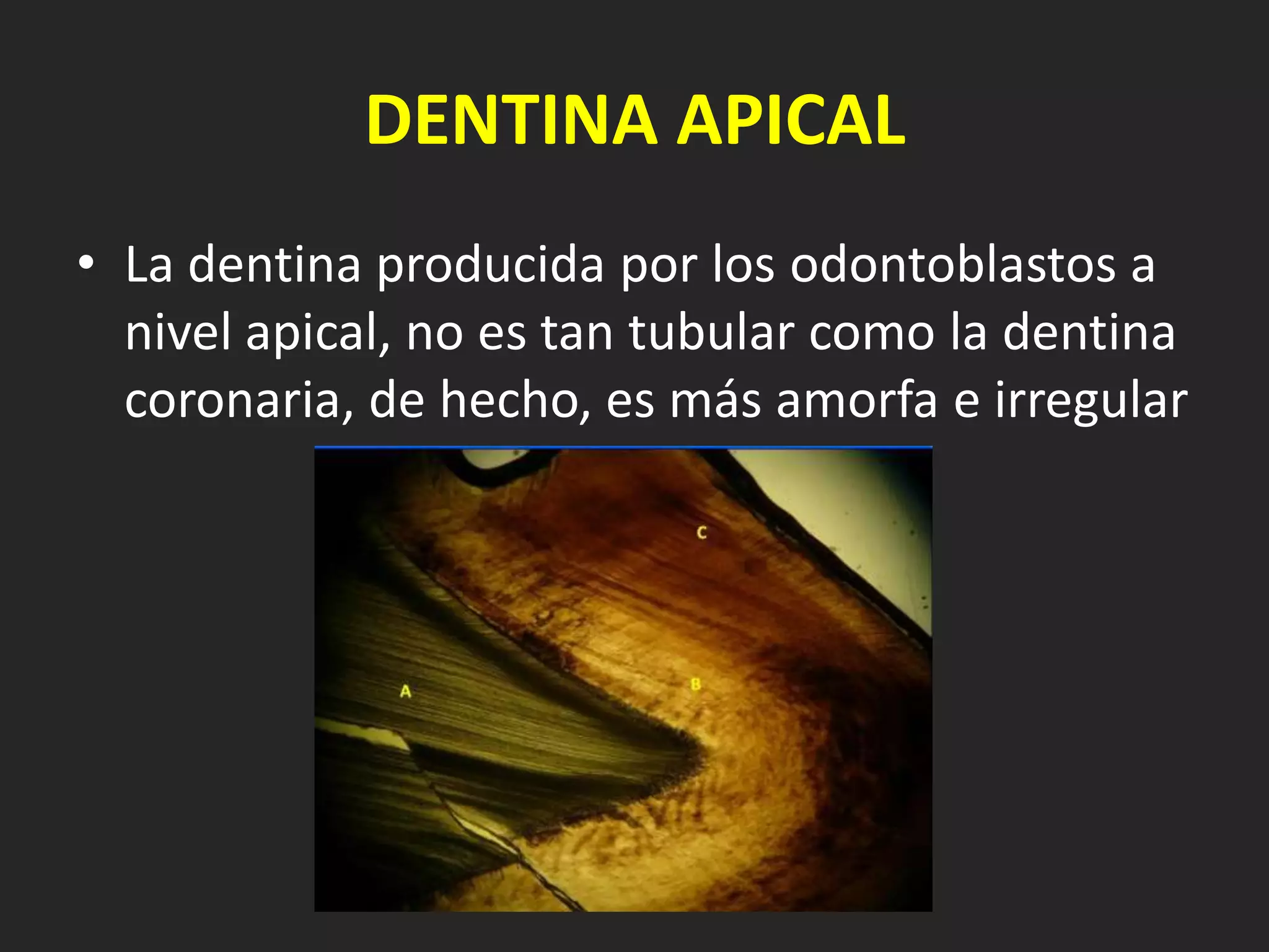 DENTINA APICAL
• La dentina producida por los odontoblastos a
  nivel apical, no es tan tubular como la dentina
  coronaria, de hecho, es más amorfa e irregular
 