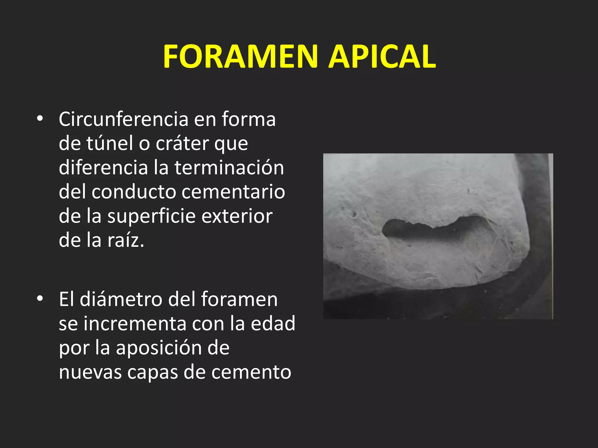 FORAMEN APICAL
• Circunferencia en forma
  de túnel o cráter que
  diferencia la terminación
  del conducto cementario
  de la superficie exterior
  de la raíz.

• El diámetro del foramen
  se incrementa con la edad
  por la aposición de
  nuevas capas de cemento
 