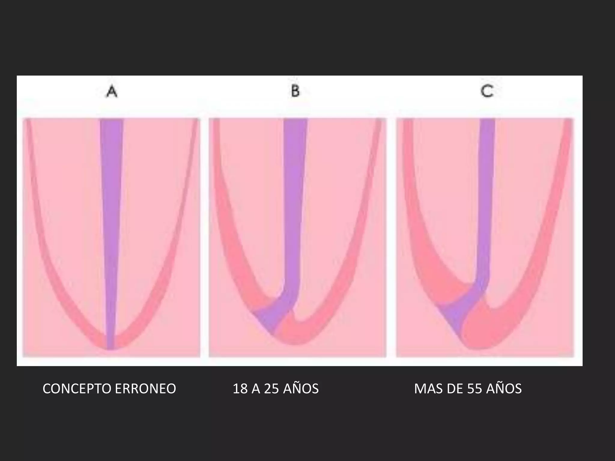 CONCEPTO ERRONEO   18 A 25 AÑOS   MAS DE 55 AÑOS
 