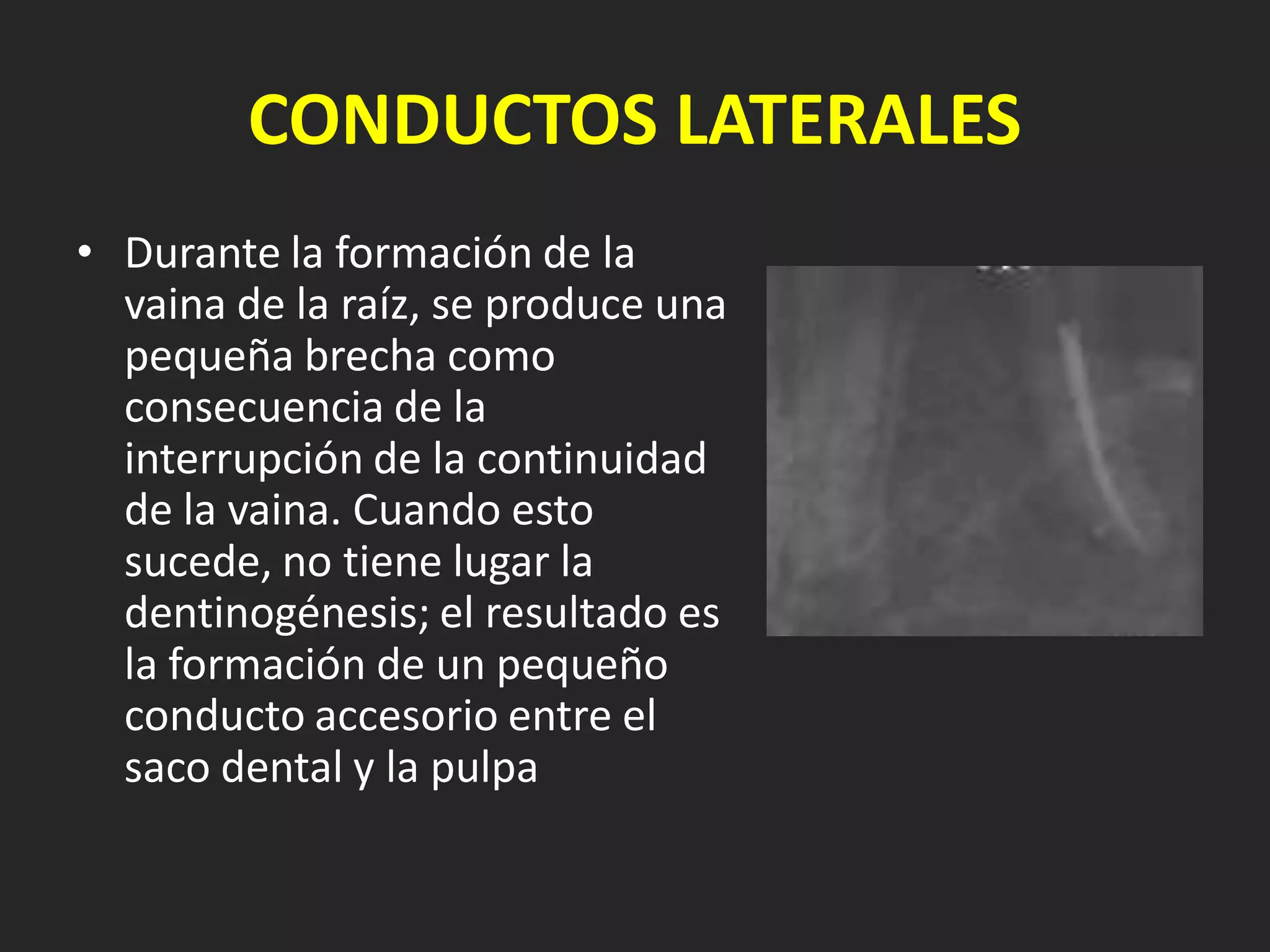 CONDUCTOS LATERALES
• Durante la formación de la
  vaina de la raíz, se produce una
  pequeña brecha como
  consecuencia de la
  interrupción de la continuidad
  de la vaina. Cuando esto
  sucede, no tiene lugar la
  dentinogénesis; el resultado es
  la formación de un pequeño
  conducto accesorio entre el
  saco dental y la pulpa
 