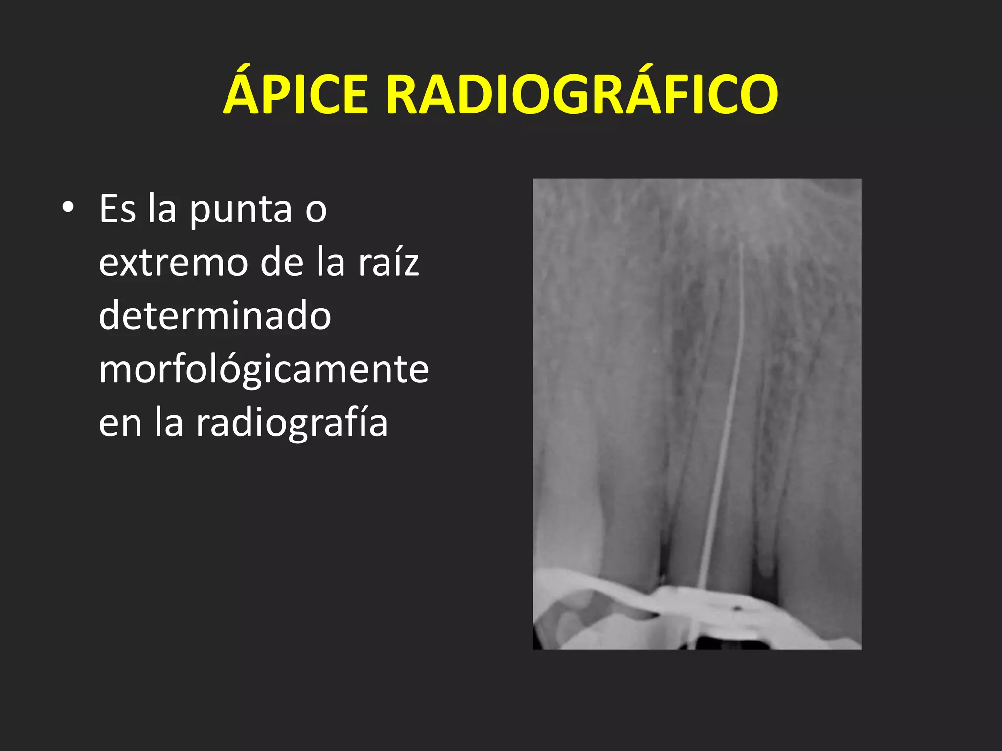 ÁPICE RADIOGRÁFICO
• Es la punta o
  extremo de la raíz
  determinado
  morfológicamente
  en la radiografía
 