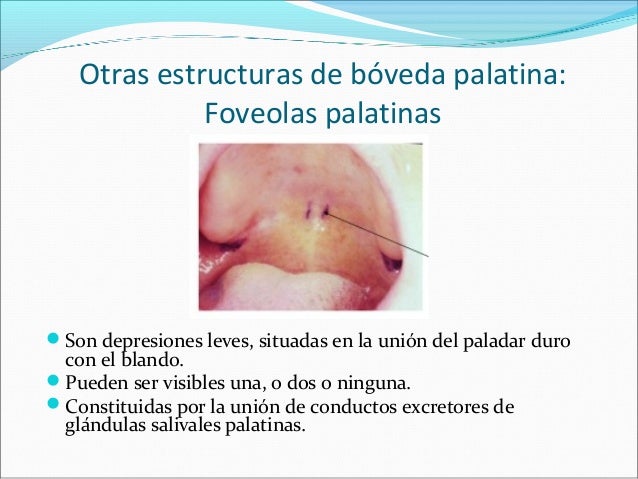 Ask Appear Unhinged Arctiids