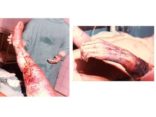 2 danger electrique danger electrique.ppt