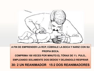 A FIN DE EMPRENDER LA RCP, CÚBRALE LA BOCA Y NARIZ CON SU
PROPIA BOCA.
COMPRIMA 100 VECES POR MINUTO EL TÓRAX DE 1½ PULG.,
EMPLEANDO SOLAMENTE DOS DEDOS Y DEJÁNDOLO RESPIRAR
30: 2 UN REANIMADOR 15:2 DOS REANIMADORES
 