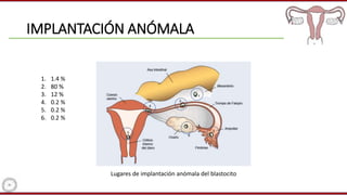 IMPLANTACIÓN ANÓMALA
Lugares de implantación anómala del blastocito
1. 1.4 %
2. 80 %
3. 12 %
4. 0.2 %
5. 0.2 %
6. 0.2 %
 