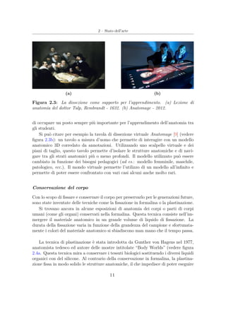 2 – Stato dell’arte
(a) (b)
Figura 2.3: La dissezione come supporto per l’apprendimento. (a) Lezione di
anatomia del dottor Tulp, Rembrandt - 1632. (b) Anatomage - 2012.
di occupare un posto sempre più importante per l’apprendimento dell’anatomia tra
gli studenti.
Si può citare per esempio la tavola di dissezione virtuale Anatomage [9] (vedere
ﬁgura 2.3b): un tavolo a misura d’uomo che permette di interagire con un modello
anatomico 3D corredato da annotazioni. Utilizzando uno scalpello virtuale e dei
piani di taglio, questo tavolo permette d’isolare le strutture anatomiche e di navi-
gare tra gli strati anatomici più o meno profondi. Il modello utilizzato può essere
cambiato in funzione dei bisogni pedagogici (ad es.: modello femminile, maschile,
patologico, ecc.). Il mondo virtuale permette l’utilizzo di un modello all’inﬁnito e
permette di poter essere confrontato con vari casi alcuni anche molto rari.
Conservazione del corpo
Con lo scopo di ﬁssare e conservare il corpo per preservarlo per le generazioni future,
sono state inventate delle tecniche come la ﬁssazione in formalina o la plastinazione.
Si trovano ancora in alcune esposizioni di anatomia dei corpi o parti di corpi
umani (come gli organi) conservati nella formalina. Questa tecnica consiste nell’im-
mergere il materiale anatomico in un grande volume di liquido di ﬁssazione. La
durata della ﬁssazione varia in funzione della grandezza del campione e sfortunata-
mente i colori del materiale anatomico si sbiadiscono man mano che il tempo passa.
La tecnica di plastinazione è stata introdotta da Gunther von Hagens nel 1977,
anatomista tedesco ed autore delle mostre intitolate “Body Worlds” (vedere ﬁgura
2.4a. Questa tecnica mira a conservare i tessuti biologici sostituendo i diversi liquidi
organici con del silicone. Al contrario della conservazione in formalina, la plastina-
zione ﬁssa in modo solido le strutture anatomiche, il che impedisce di poter eseguire
11
 