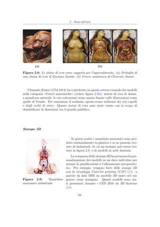 2 – Stato dell’arte
(a) (b)
Figura 2.8: Le statue di cera come supporto per l’apprendimento. (a) Dettaglio di
una statua di cera di Gaetano Zumbo. (b) Venere anatomica di Clemente Susini.
Clemente Susini (1754-1814) ha contribuito in questo settore creando dei modelli
nella categoria «Veneri anatomiche» (vedere ﬁgura 2.8b): statue di cera di donne,
a grandezza naturale, le cui costruzioni erano spesso basate sulle illustrazioni come
quelle di Vesalio. Per aumentare il realismo, spesso erano utilizzati dei veri capelli
e degli occhi di vetro. Queste statue di cera sono state create con lo scopo di
demistiﬁcare la dissezione tra il grande pubblico.
Stampa 3D
Ai giorni nostri i manichini anatomici sono pro-
Figura 2.9: Manichino
anatomico industriale.
dotti essenzialmente in plastica e se ne possono tro-
vare di industriali, di cui un esempio può essere tro-
vato in ﬁgura 2.9, o di modelli in serie limitata.
La comparsa della stampa 3D ha permesso la per-
sonalizzazione dei modelli su un dato individuo per
aiutare la pianiﬁcazione e l’allenamento preoperato-
rio. Per esempio, vengono fatte delle stampe 3D
con la tecnologia ColorJet printing (CJP) [15]: a
partire da dati MRI un modello 3D unico nel suo
genere viene stampato. Questi modelli sono sta-
ti presentati durante i CES 2016 da 3D Systems
[16].
16
 