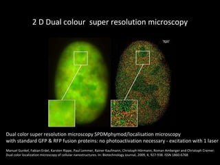 2 D Dual colour  super resolution microscopy Dual color super resolution microscopy SPDMphymod/localisation microscopy  with standard GFP & RFP fusion proteins: no photoactivation necessary - excitation with 1 laser  Manuel Gunkel, Fabian Erdel, Karsten Rippe, Paul Lemmer, Rainer Kaufmann, Christoph Hörmann, Roman Amberger and Christoph Cremer: Dual color localization microscopy of cellular nanostructures. In: Biotechnology Journal, 2009, 4, 927-938. ISSN 1860-6768 