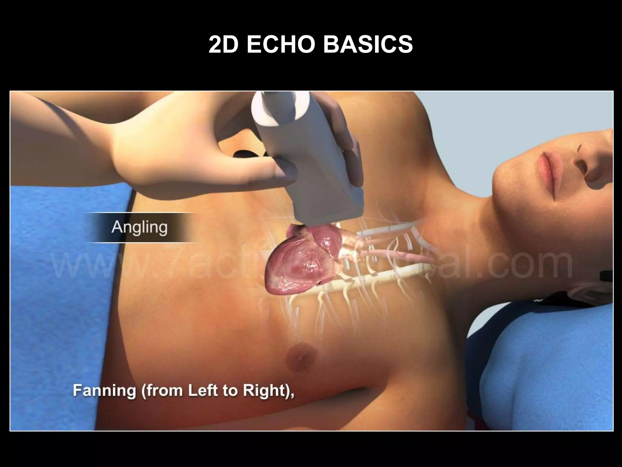 2D ECHO BASICS
 