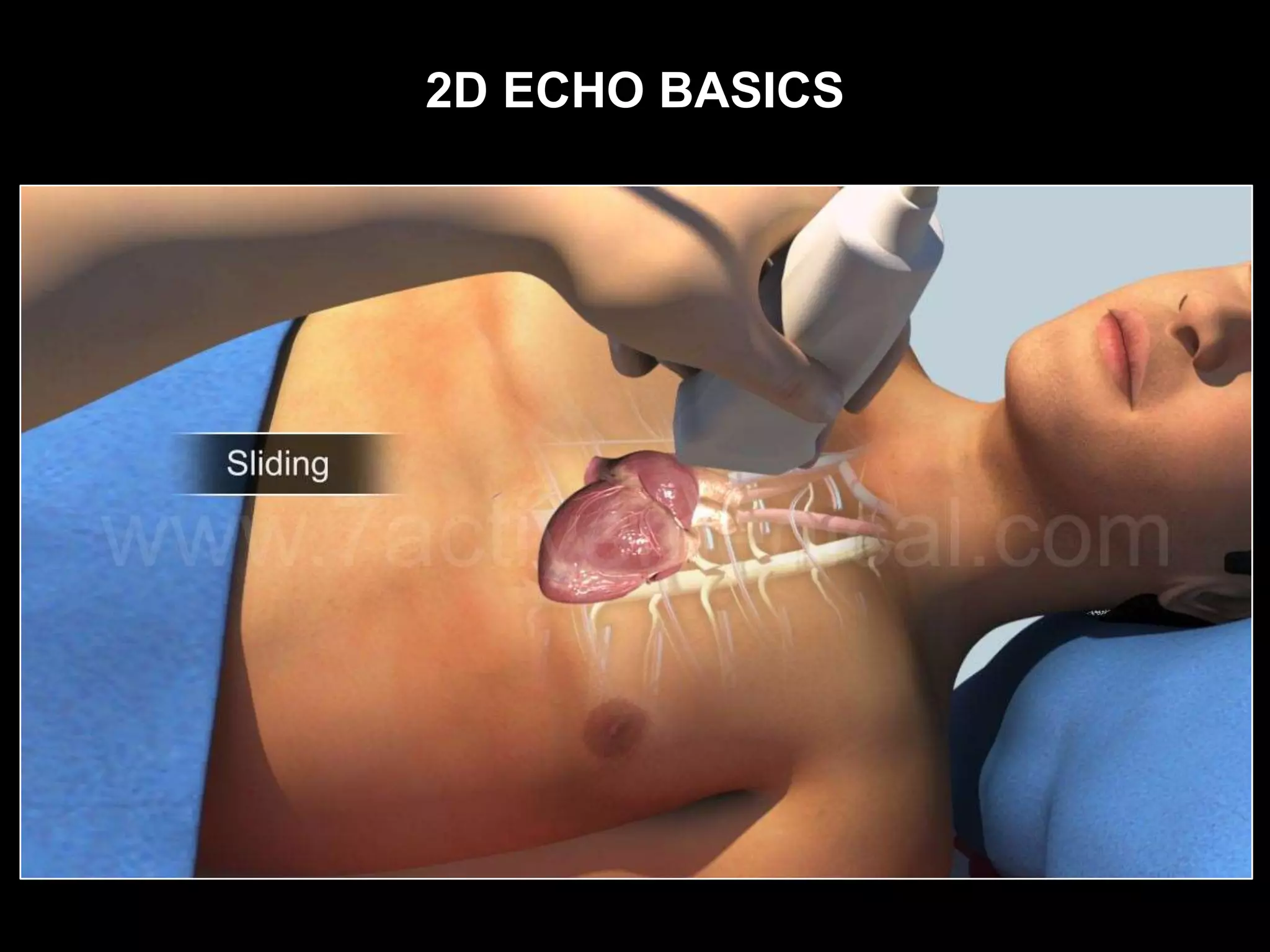 2D ECHO BASICS
 