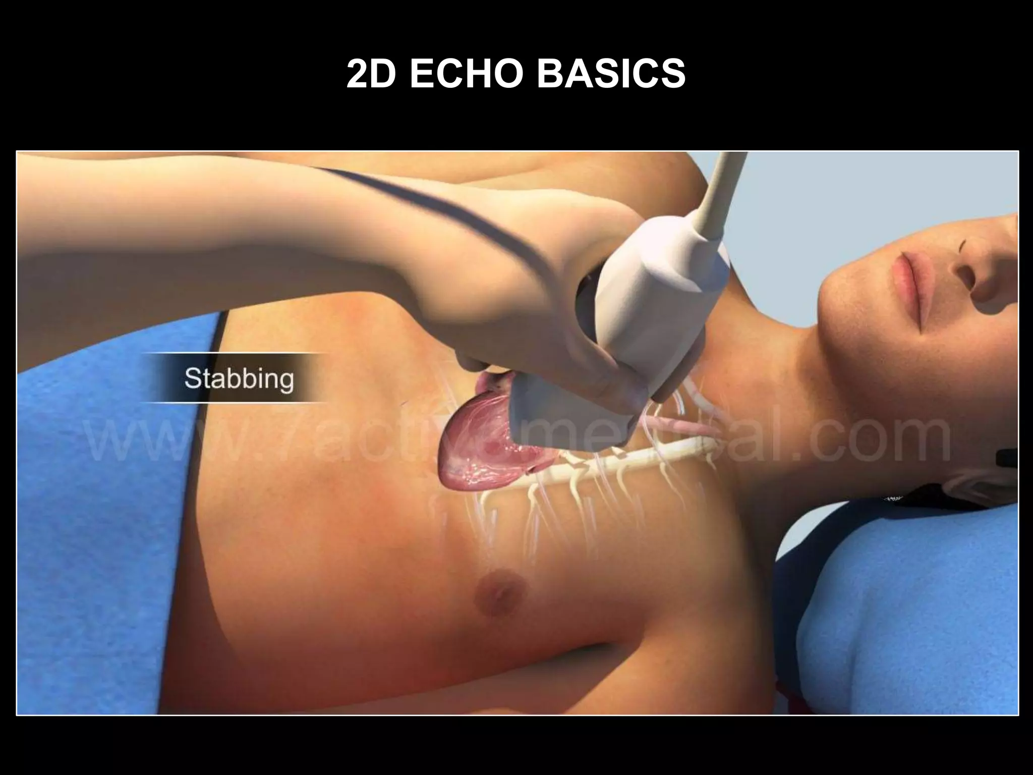 2D ECHO BASICS
 