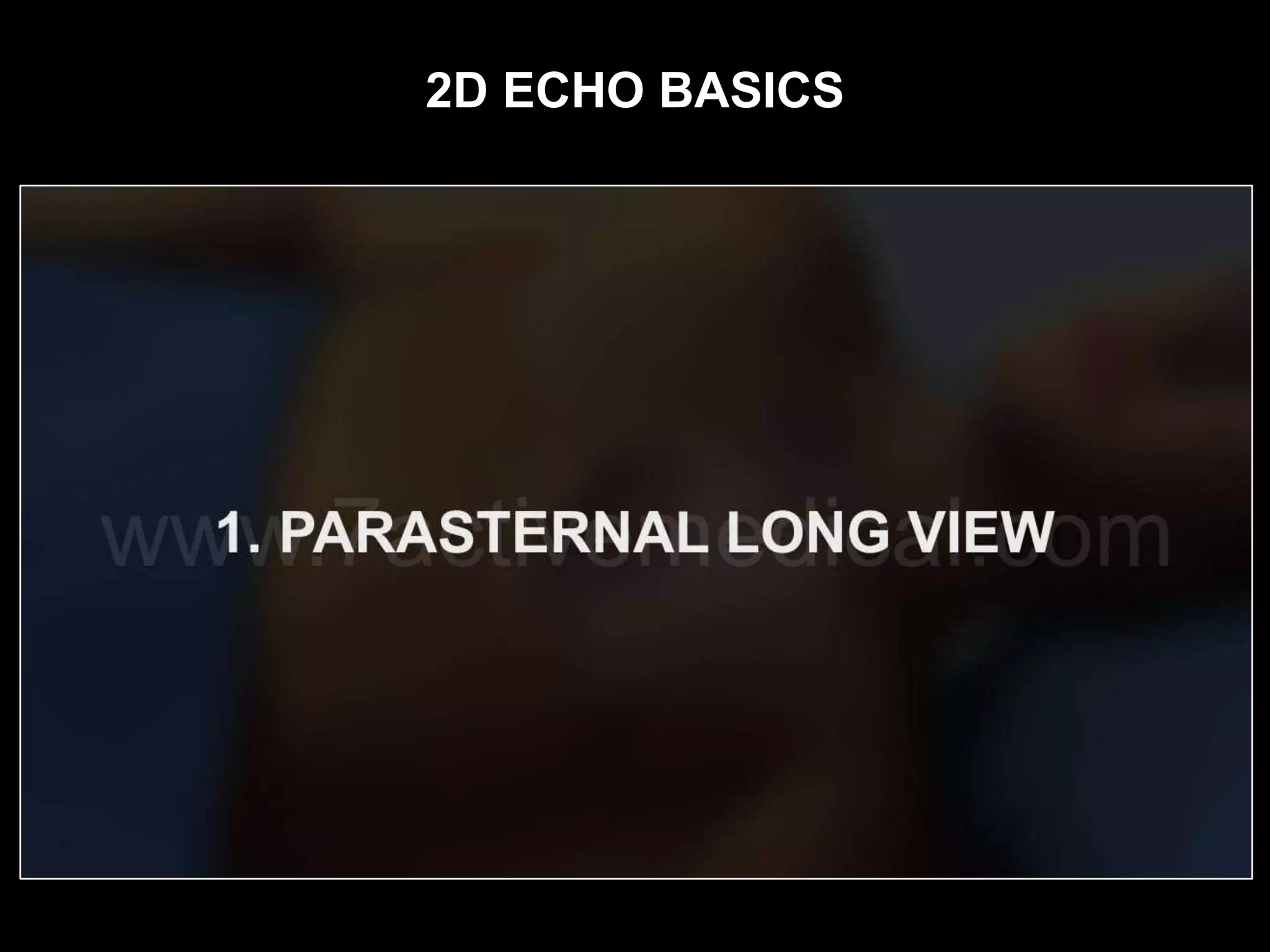 2D ECHO BASICS
 