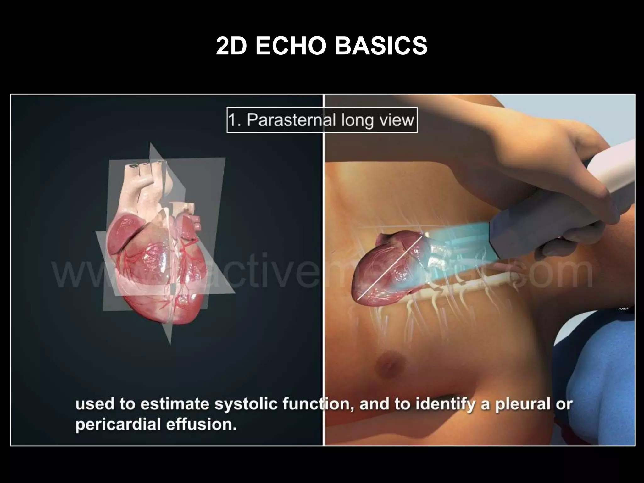 2D ECHO BASICS
 