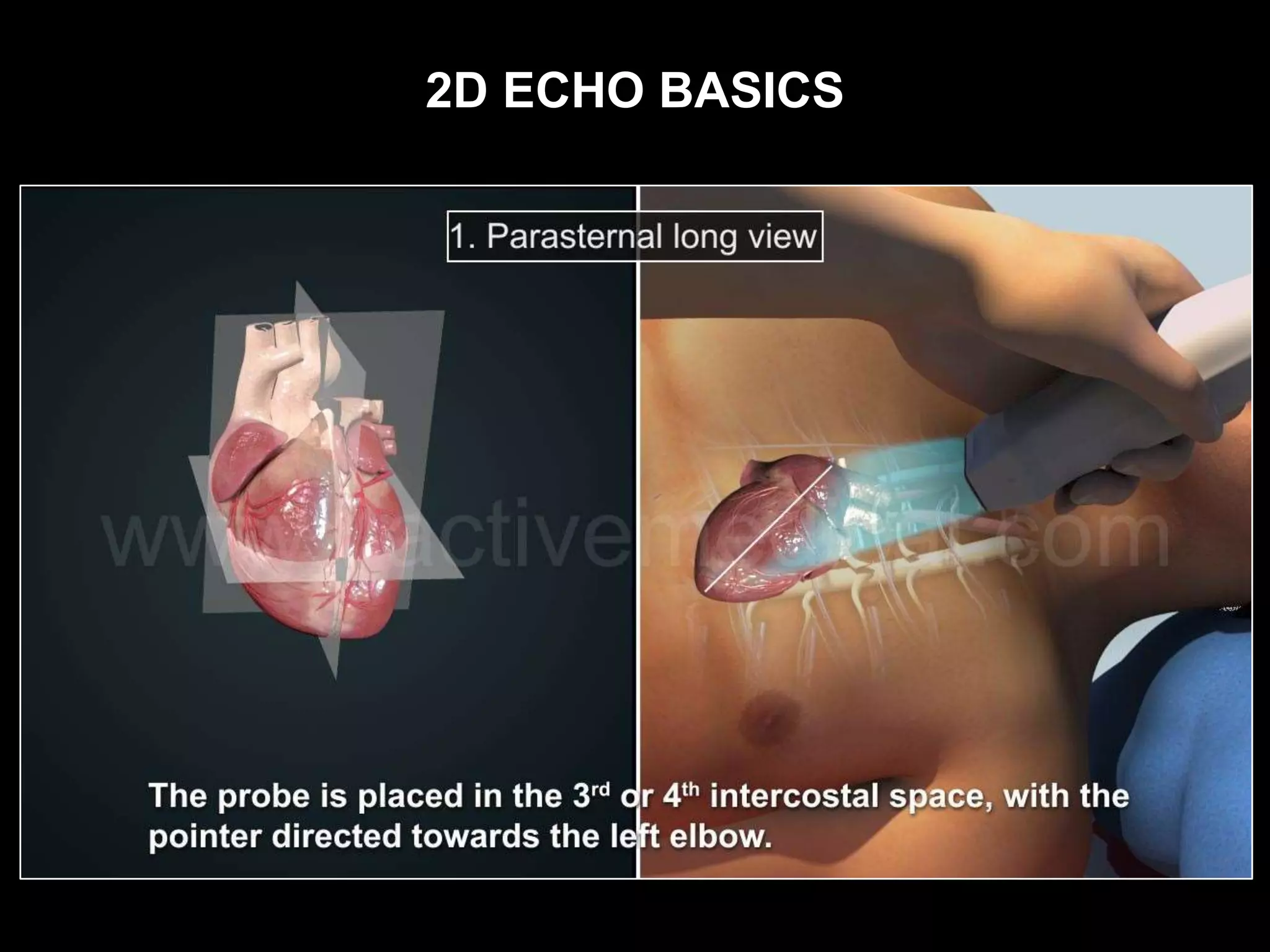 2D ECHO BASICS
 