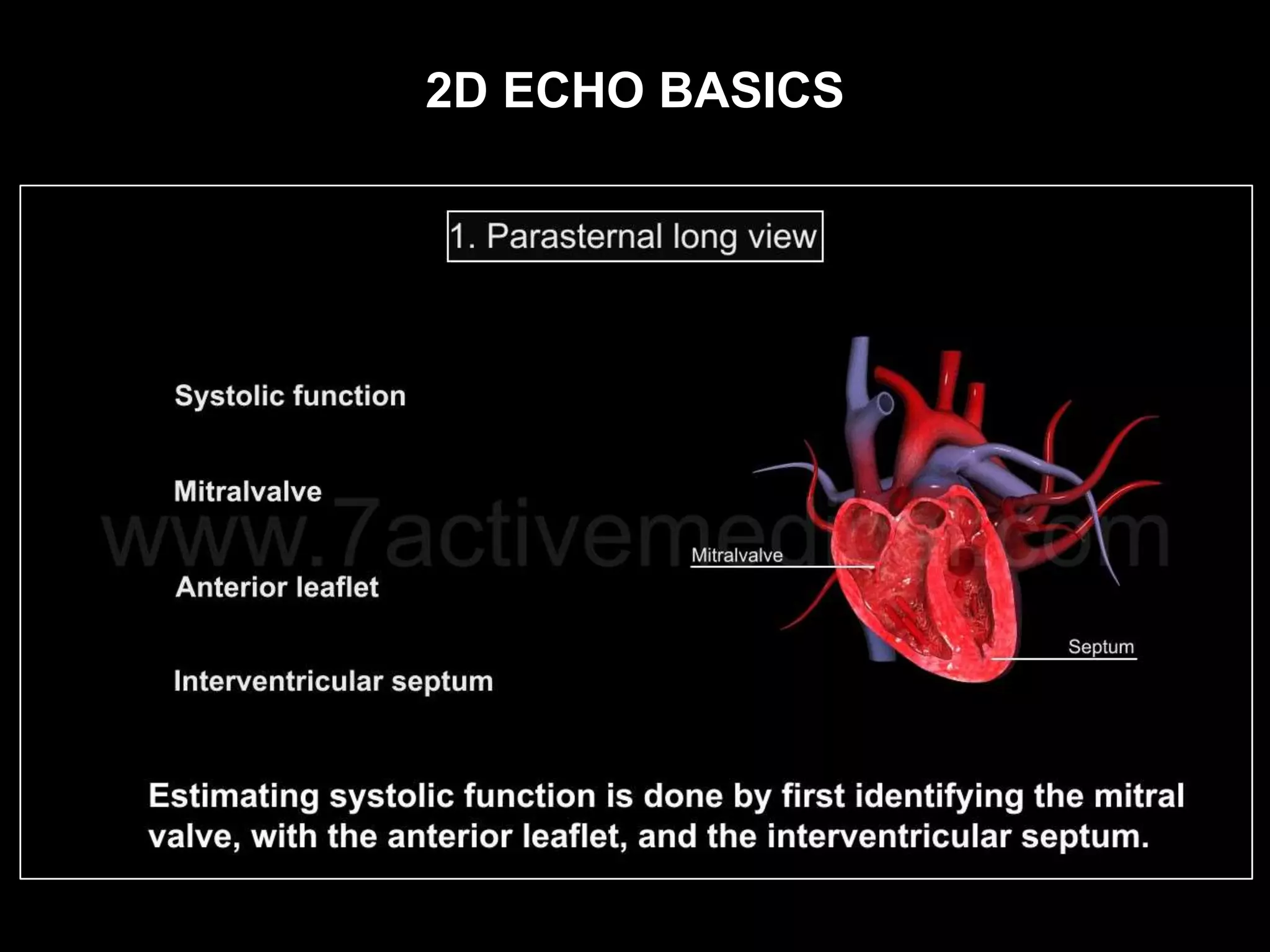 2D ECHO BASICS
 